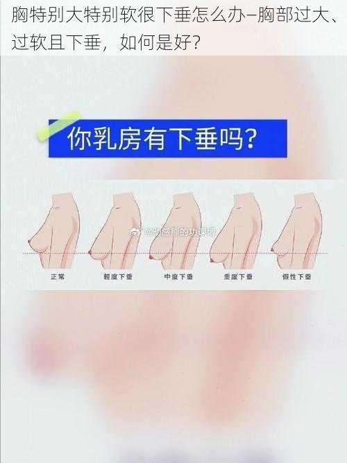 胸特别大特别软很下垂怎么办—胸部过大、过软且下垂，如何是好？